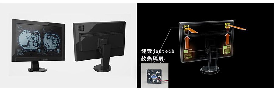 健策jentech散热风扇在医疗显示器的应用